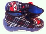 0-110P188 SPEEDY czarna kratka kapcie buciki obuwie dziecięce poniemowlęce Befado  18-26 - galeria - foto#3
