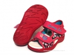 01-065P035 SUNNY różowe sandałki - sandały profilaktyczne  - kapcie obuwie dziecięce Befado  20-25 - galeria - foto#1